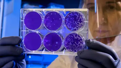 Nanomedikamente werden besser auf einige Krebserkrankungen abzielen