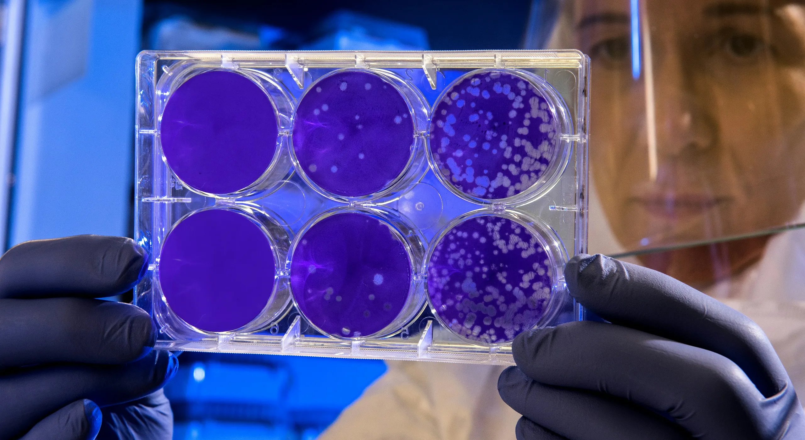Nanomedikamente werden besser auf einige Krebserkrankungen abzielen